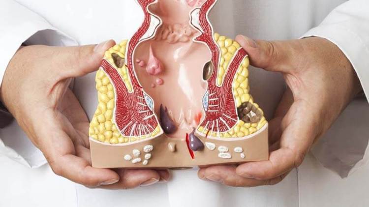 Jual Obat Wasir Ambeien De Nature Pengiriman ke Sarolangun